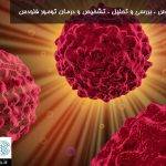 تشخیص و درمان تومور فلودس